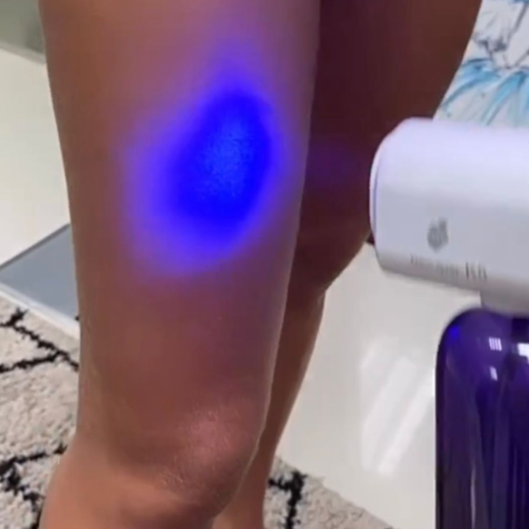Luz azul – Avulso