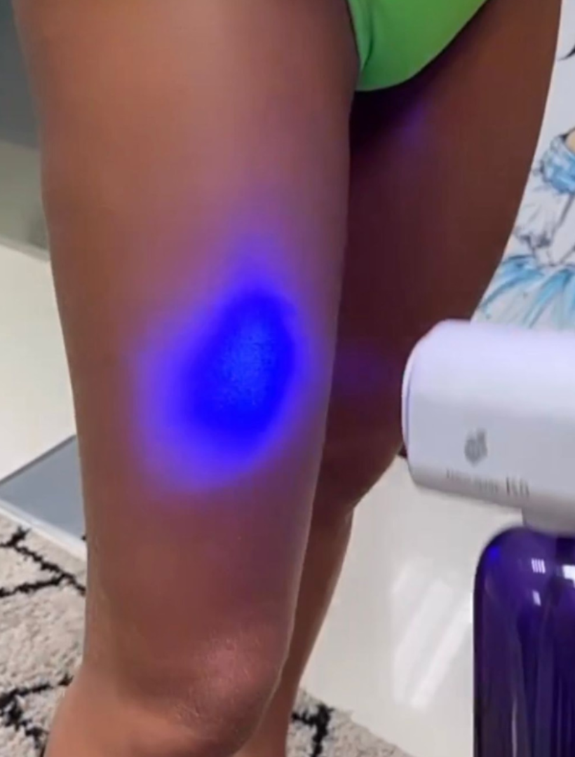 Pcte Luz Azul – Pague 4 e Ganhe 1