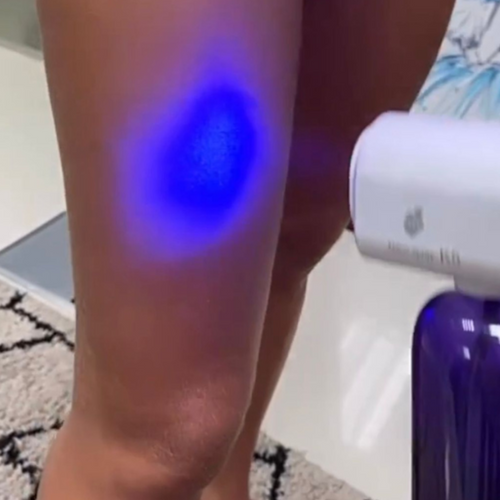Luz azul – Avulso
